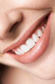 Non Prep Veneers-Hollywood Smile made in Germany