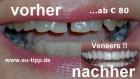 Zahnbehandlung in Tschechien - günstiger als Ungarn