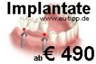 ZAHN-Behandlung CZ -günstiger als Ungarn/Polen- Implantate Euro 490