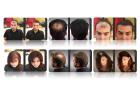Haarverdichtung Haarauffüllung mit HAIRFOR2 Hollywoods bestgehütetes Geheimnis