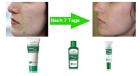 Serie gegen Akne Natur-Kosmetik - effektiv gegen Pickeln Mitesser und Narben