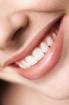 Non Prep Veneers-Hollywood Smile made in Germany