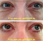 Faltenfrei in wenigen Minuten Anti-Aging der neuen Ära Sofort-Lifting pur